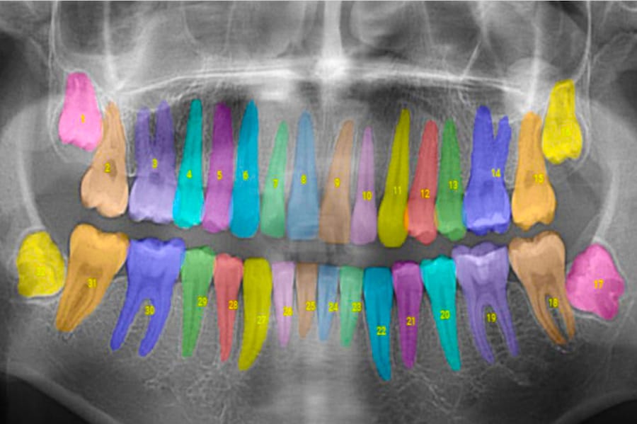 AI-assisted dental treatment Post feature image