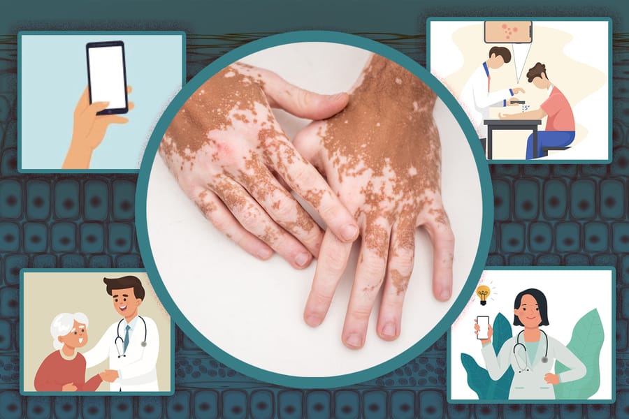 Piction Health and the treatment of skin diseases using machine learning Post feature image