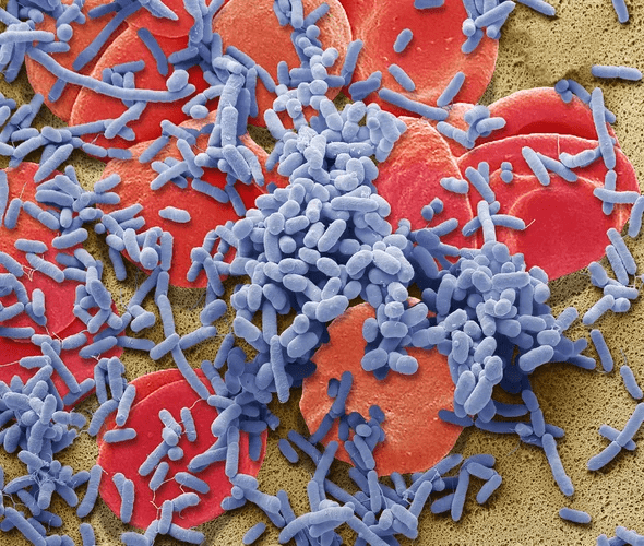 An algorithm that detects sepsis reduces deaths by nearly 20 percent Post feature image